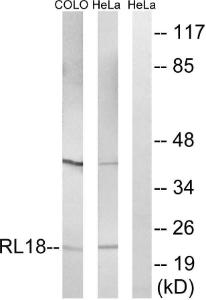 Western blot analysis of lysates from HeLa and COLO cells using Anti-RPL18 Antibody. The right hand lane represents a negative control, where the antibody is blocked by the immunising peptide