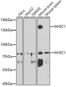 Anti-WHSC1/NSD2 antibody