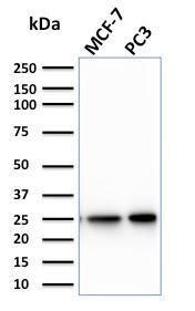 Western blot analysis of MCF-7 and PC3 cell lysates using Anti-CHP2 Antibody [CPTC-CHP2-1]