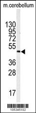 Anti-ITPKA Rabbit Polyclonal Antibody