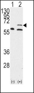 Anti-MMP14 Rabbit Polyclonal Antibody (HRP (Horseradish Peroxidase))