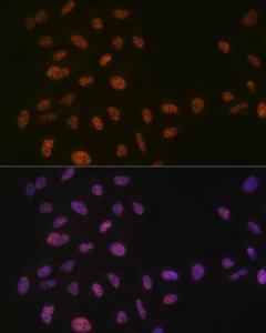 Anti-PRPF8/Prp8 Rabbit Monoclonal Antibody [clone: ARC1038]