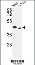 Anti-ITPKA Rabbit Polyclonal Antibody