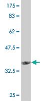 Anti-ANGPTL7 Mouse Monoclonal Antibody [clone: 2C6]