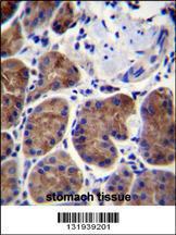 Anti-PPP4R1L Rabbit Polyclonal Antibody (HRP (Horseradish Peroxidase))