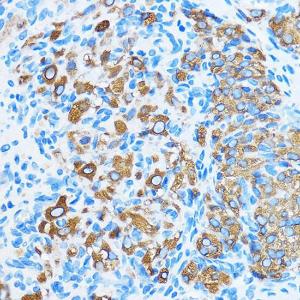 Anti-COG1 Rabbit Polyclonal Antibody