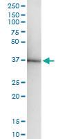 Anti-ZNF396 Rabbit Polyclonal Antibody