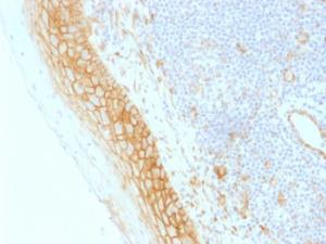 Immunohistochemical analysis of formalin-fixed, paraffin-embedded human tonsil using Anti-beta Catenin Antibody [CTNNB1/1509]