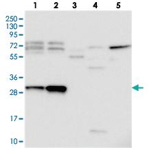 Anti-KNSTRN Rabbit Polyclonal Antibody