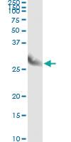 Anti-CLIC3 Antibody Pair