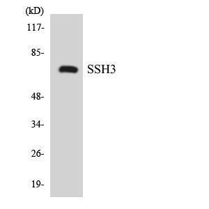 Western blot analysis of the lysates from K562 cells using Anti-SSH3 Antibody