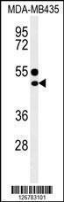 Anti-CD1E Rabbit Polyclonal Antibody (AP (Alkaline Phosphatase))