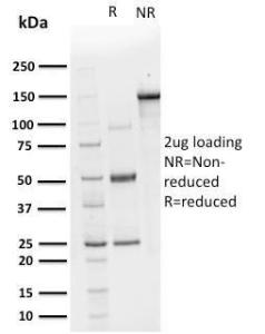 SDS-PAGE analysis of Anti-CHP2 Antibody [CPTC-CHP2-1] under non-reduced and reduced conditions; showing intact IgG and intact heavy and light chains, respectively SDS-PAGE analysis confirms the integrity and purity of the antibody