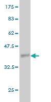 Anti-ANGPTL7 Mouse Monoclonal Antibody [clone: 3F1]