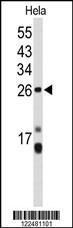 Anti-CENPH Rabbit Polyclonal Antibody (HRP (Horseradish Peroxidase))