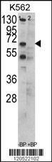 Anti-T-complex Protein 1 Subunit gamma Rabbit Polyclonal Antibody (HRP (Horseradish Peroxidase))