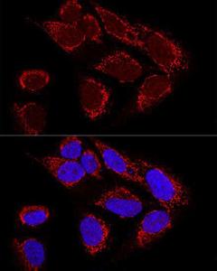 Anti-MTX2 Rabbit Polyclonal Antibody