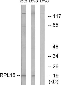 Western blot analysis of lysates from LOVO and K562 cells using Anti-RPL15 Antibody The right hand lane represents a negative control, where the antibody is blocked by the immunising peptide