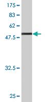 Anti-TPM2 Mouse Monoclonal Antibody [clone: 3C8]