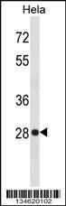 Anti-HMGB1 Rabbit Polyclonal Antibody (HRP (Horseradish Peroxidase))