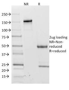 SDS-PAGE analysis of Anti-CD62L Antibody [CD62L/1588] under non-reduced and reduced conditions; showing intact IgG and intact heavy and light chains, respectively. SDS-PAGE analysis confirms the integrity and purity of the antibody