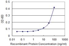 Anti-PIM1 Mouse Monoclonal Antibody [clone: 1E2]