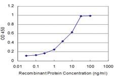 Anti-RBFOX2 Mouse Monoclonal Antibody [clone: 5E11]