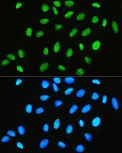 Immunofluorescence analysis of U2OS cells using Anti-CHRAC1 Antibody (A306864) at a dilution of 1:100. DAPI was used to stain the cell nuclei (blue).