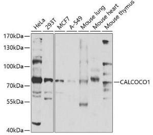 Anti-CoCoA antibody