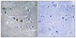 Immunohistochemical analysis of paraffin-embedded human brain using Anti-RPL15 Antibody 1:100 (4°C overnight) The right hand panel represents a negative control, where the antibody was pre-incubated with the immunising peptide