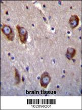 Anti-BAI1 Rabbit Polyclonal Antibody