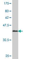 Anti-ALDH18A1 Mouse Polyclonal Antibody