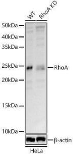 Western blot analysis of extracts from wild type(WT) and RhoA knockdown (KD) HeLa(KD) cells, using Anti-RhoA Antibody (A308049) at 1:800 dilution