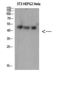 Antibody anti-SPOP 100 µg