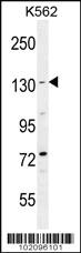 Anti-BAI1 Rabbit Polyclonal Antibody