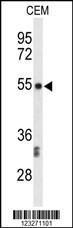 Anti-CENPI Rabbit Polyclonal Antibody (AP (Alkaline Phosphatase))