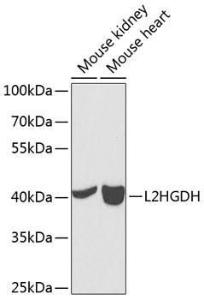 Antibody anti-L2HGDH 100 µl