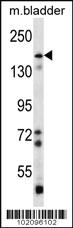 Anti-BAI1 Rabbit Polyclonal Antibody