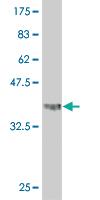 Anti-ANGPTL7 Mouse Monoclonal Antibody [clone: 1A2]