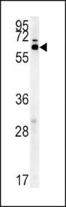 Anti-IKZF3 Rabbit Polyclonal Antibody (FITC (Fluorescein Isothiocyanate))