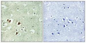 Immunohistochemical analysis of paraffin-embedded human brain using Anti-RPL15 Antibody 1:100 (4°C overnight) The right hand panel represents a negative control, where the antibody was pre-incubated with the immunising peptide