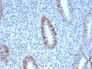 Immunohistochemical analysis of formalin-fixed, paraffin-embedded human endometrium using Anti-Cyclin E Antibody [CCNE1/4935R]