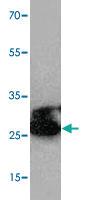 Anti-CA3 Rabbit Polyclonal Antibody