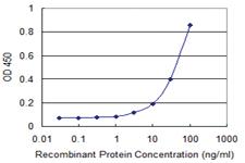 Anti-PIM1 Mouse Monoclonal Antibody [clone: 7D11]