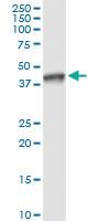 Anti-NSDHL Polyclonal Antibody Pair