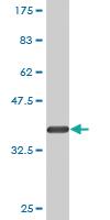 Anti-CPSF3 Mouse Monoclonal Antibody [clone: 6E6]