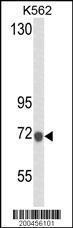 Anti-LTF Mouse Monoclonal Antibody (FITC (Fluorescein Isothiocyanate)) [clone: 119CT80.1.1]