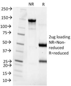 SDS-PAGE analysis of Anti-Cytokeratin 8 Antibody [SPM538] under non-reduced and reduced conditions; showing intact IgG and intact heavy and light chains, respectively. SDS-PAGE analysis confirms the integrity and purity of the antibody.