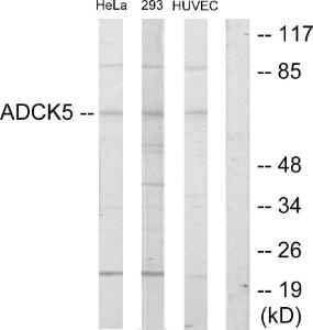 Anti-ADCK5 antibody