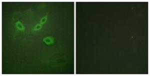 Immunofluorescence analysis of HeLa cells using Anti-TUSC5 Antibody. The right hand panel represents a negative control, where the antibody was pre-incubated with the immunising peptide.